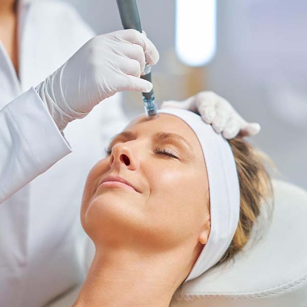 Skin needling treatment at Face and Body Clinic, Williamstown
